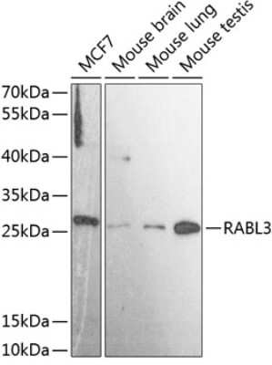 Western Blot: RABL3 AntibodyAzide and BSA Free [NBP2-93273]