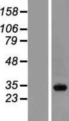 Western Blot: RABL3 Overexpression Lysate [NBL1-15101]