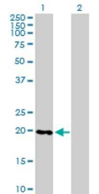 Western Blot: RABL4 Antibody [H00011020-B01P]