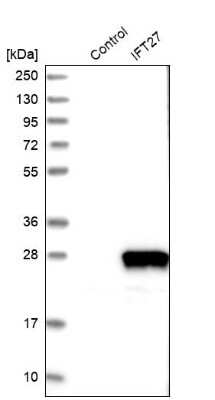 Western Blot: RABL4 Antibody [NBP1-87170]