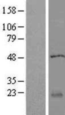 Western Blot: RABL5 Overexpression Lysate [NBL1-15103]