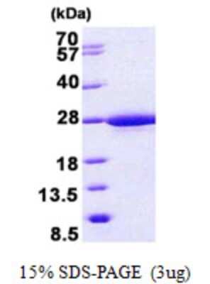 SDS-PAGE: Recombinant Human RABL5 His Protein [NBP2-23391]