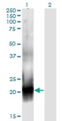 Western Blot: RAC2 Antibody (3B8) [H00005880-M08]