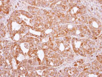 Immunohistochemistry-Paraffin: RAC2 Antibody [NBP1-33449]
