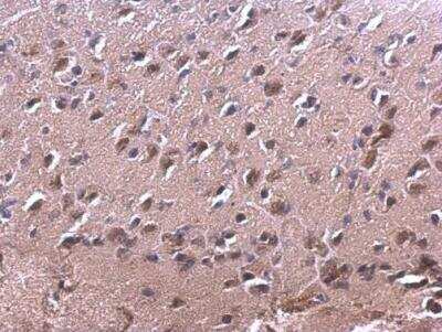 Immunohistochemistry-Paraffin: RAC2 Antibody [NBP1-33449]