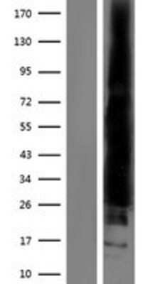 Western Blot: RAC2 Overexpression Lysate [NBP2-08063]