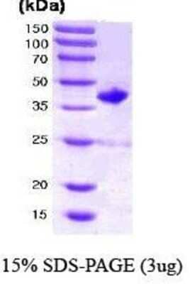 SDS-PAGE: Recombinant Human RAC2 GST (N-Term) Protein [NBC1-18403]