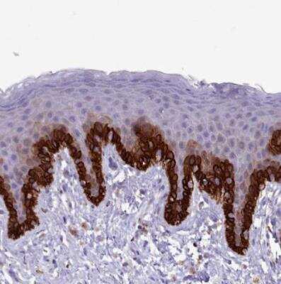 Immunohistochemistry-Paraffin: RAC3 Antibody [NBP2-32058]