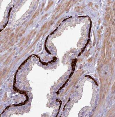 Immunohistochemistry-Paraffin: RAC3 Antibody [NBP2-32058]