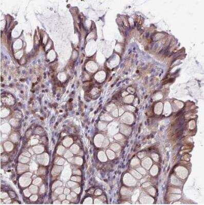 Immunohistochemistry-Paraffin: RAC3 Antibody [NBP2-32058]