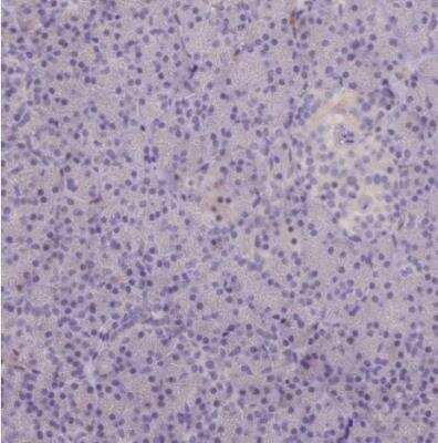 Immunohistochemistry-Paraffin: RAC3 Antibody [NBP2-32058]