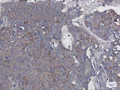 Immunohistochemistry-Paraffin: RAC3 Antibody (S01-6I8) [NBP3-19756]