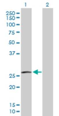 Western Blot: RAC3 Antibody [H00005881-D01P]