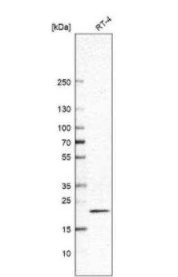 Western Blot: RAC3 Antibody [NBP2-32058]