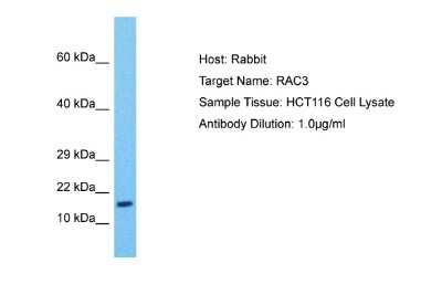 Western Blot: RAC3 Antibody [NBP2-85583]