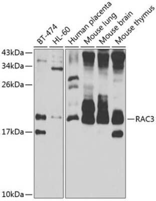 Western Blot: RAC3 AntibodyBSA Free [NBP3-04493]