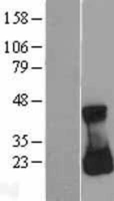 Western Blot: RAC3 Overexpression Lysate [NBL1-15107]