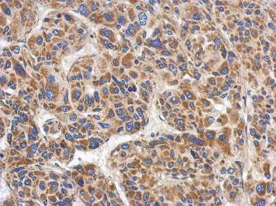Immunohistochemistry-Paraffin: MgcRacGAP/RACGAP1 Antibody [NBP2-20049]