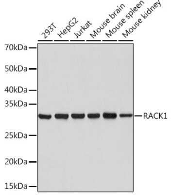 Western Blot: RACK1/GNB2L1 Antibody (7B6J4) [NBP3-16277]