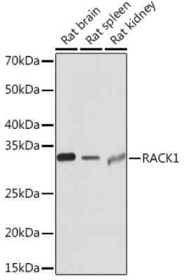 Western Blot: RACK1/GNB2L1 Antibody (7B6J4) [NBP3-16277]