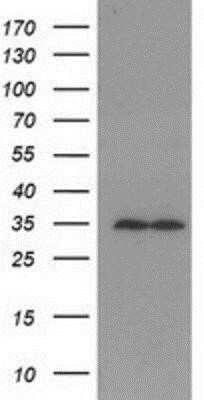 Western Blot: RACK1/GNB2L1 Antibody (OTI2D8)Azide and BSA Free [NBP2-73781]