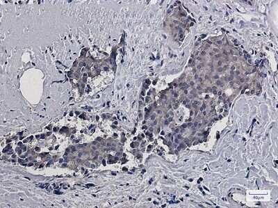 Immunohistochemistry-Paraffin: RACK1/GNB2L1 Antibody (S02-1K6) [NBP3-14967]