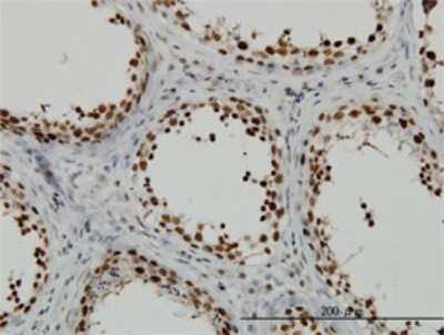 Immunohistochemistry-Paraffin: RAD18 Antibody (3H7) [H00056852-M01]