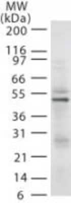 Western Blot: RAD18 Antibody (79B1048.1) [NB100-56523]