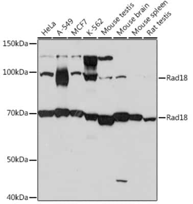 Western Blot: RAD18 Antibody (9Y1H3) [NBP3-16377]