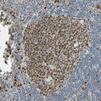 Immunohistochemistry: RAD18 Antibody [NBP2-33851]