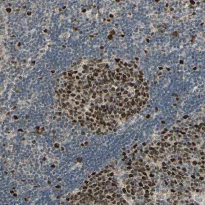 Immunohistochemistry: RAD18 Antibody [NBP2-33865]