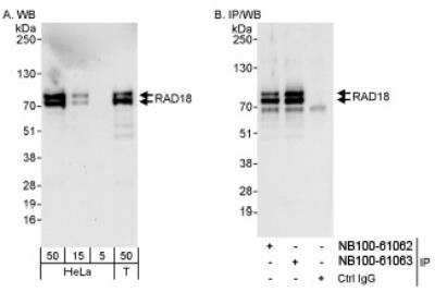 Western Blot: RAD18 Antibody [NB100-61063]