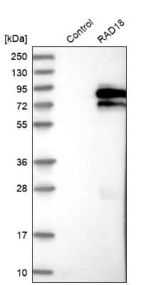 Western Blot: RAD18 Antibody [NBP2-33865]