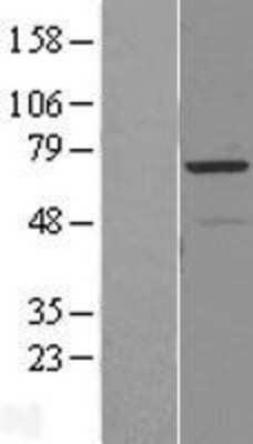 Western Blot: RAD18 Overexpression Lysate [NBL1-15113]