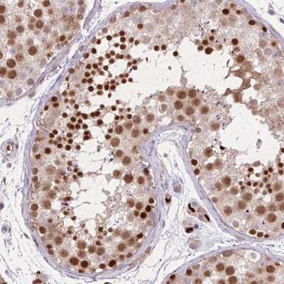 Immunohistochemistry-Paraffin: RAD21L1 Antibody [NBP2-14779]