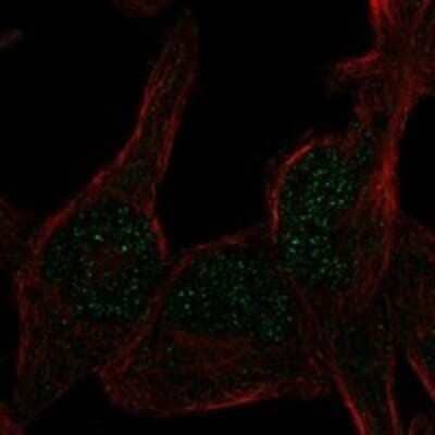 Immunocytochemistry/ Immunofluorescence: RAD26L Antibody [NBP3-17300]