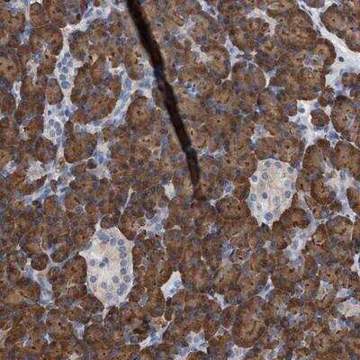 Immunohistochemistry-Paraffin: RAD26L Antibody [NBP1-81944]