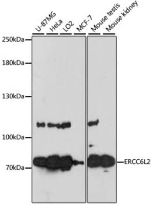 Western Blot: RAD26L AntibodyAzide and BSA Free [NBP2-94416]