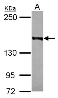 Western Blot: Rad50 Antibody [NBP2-20054]