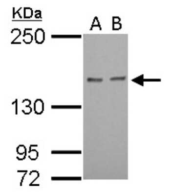Western Blot: Rad50 Antibody [NBP2-20055]