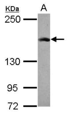 Western Blot: Rad50 Antibody [NBP2-20055]