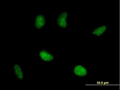 Immunocytochemistry/ Immunofluorescence: RAD51AP1 Antibody [H00010635-B02P]