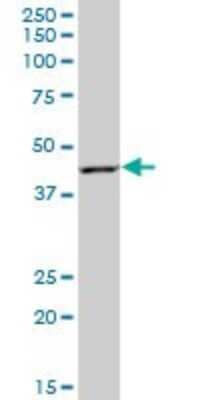 Western Blot: RAD51AP1 Antibody [H00010635-B02P]