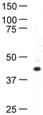 Western Blot: RAD52 Antibody (5H9) [NBP1-41208]