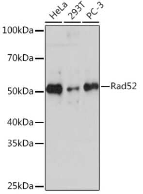 Western Blot: RAD52 Antibody (7H5K0) [NBP3-16584]