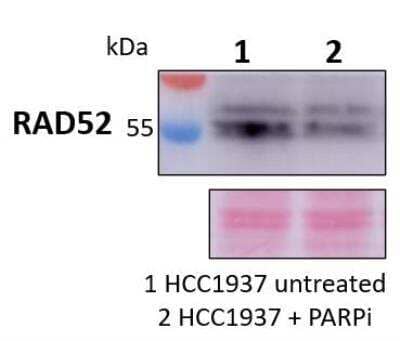 Western Blot: RAD52 Antibody [NBP2-58116]