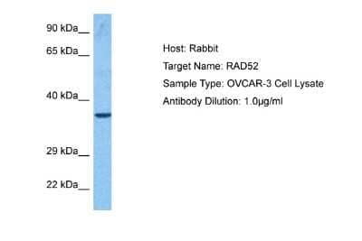 Western Blot: RAD52 Antibody [NBP2-85584]