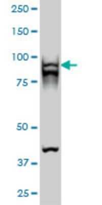 Western Blot: RAD54B Antibody (4A7) [H00025788-M01]