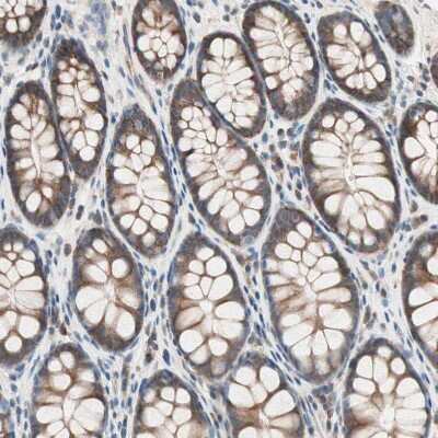 Immunohistochemistry-Paraffin: RAD54B Antibody [NBP1-83417]