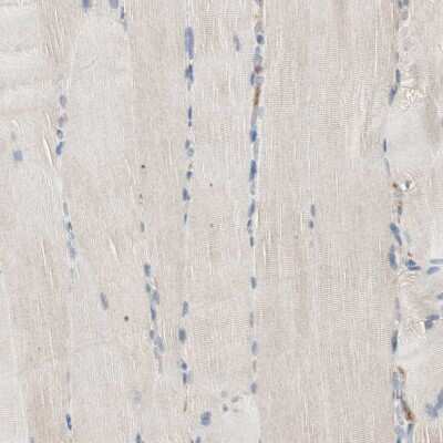 Immunohistochemistry-Paraffin: RAD54B Antibody [NBP1-83417]